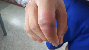 深圳無痛胃鏡：舒適檢查，健康無憂