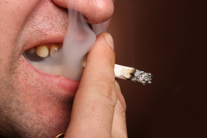 牙周病初期唔好忽視，及時治療保健康