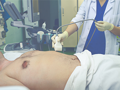 深圳大腸內窺鏡檢查：早期發現，健康保障