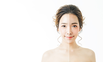 怎樣才能 纔能真正有效祛斑？深圳博愛曙光醫院美容科專業解答